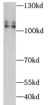ATP2A2 Antibody