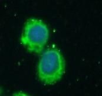 ATP2A2 Antibody