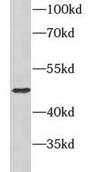 CD82 Mouse Monoclonal Antibody