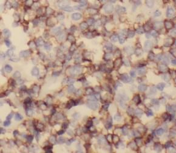 CD82 Mouse Monoclonal Antibody