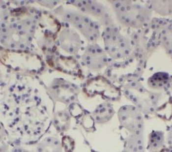 AQP2 Antibody