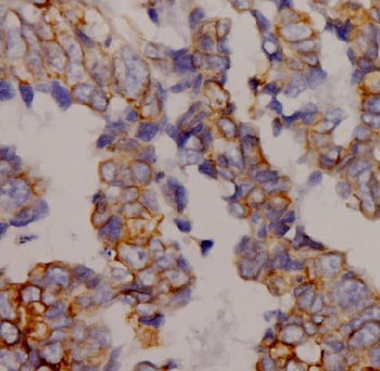 AQP9 Antibody