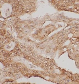 putrescine Rabbit Polyclonal Antibody