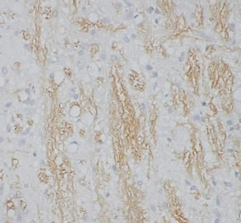 Spermine Rabbit Polyclonal Antibody