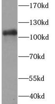 PARP1 Antibody