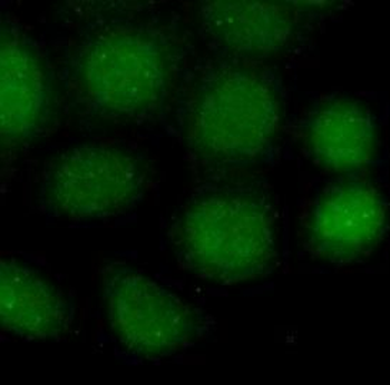 PARP1 Antibody