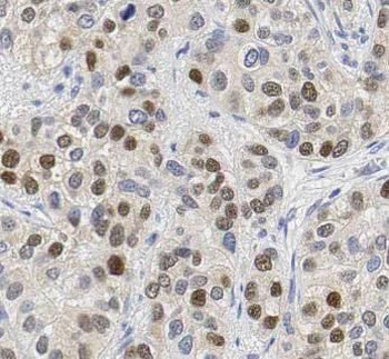 PARP1 Antibody