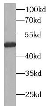 AKT1S1 Antibody