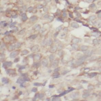 AKT1S1 Antibody