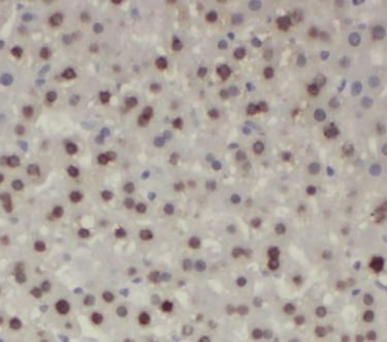 Phospho-AKT1S1 (T246) Antibody