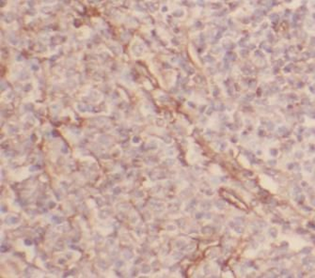 NOS3 Rabbit Polyclonal Antibody