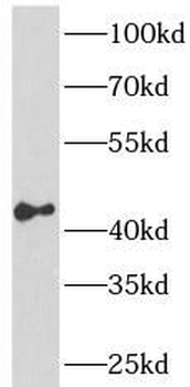 CREB1 Rabbit Polyclonal Antibody