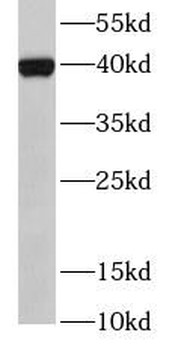 HLA G Mouse Monoclonal Antibody