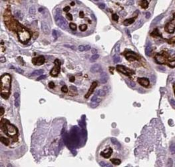 HLA G Mouse Monoclonal Antibody