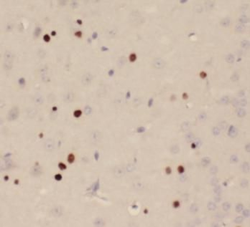 ZEB2 Antibody