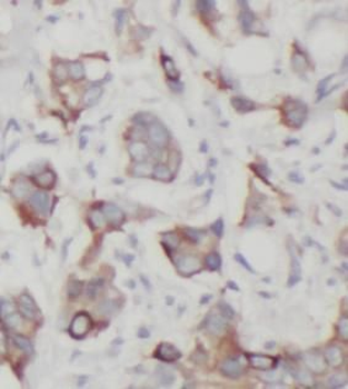 HK2 Antibody