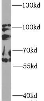 PIK3R1 Rabbit Polyclonal Antibody