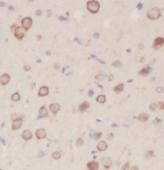 PIK3R1 Rabbit Polyclonal Antibody