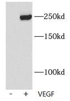 Phospho-VEGF Receptor 2 (Y1175) Antibody