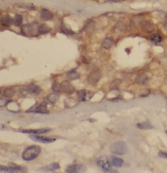 Phospho-VEGF Receptor 2 (Y1175) Antibody