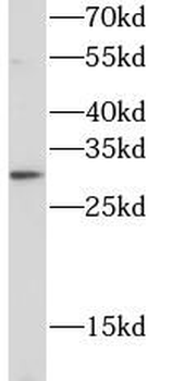 TREM1 Rabbit Polyclonal Antibody