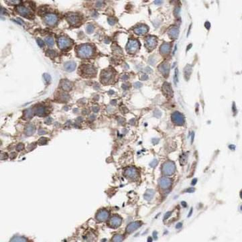 HSP90AA1 Antibody