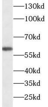 HDAC2 Rabbit Polyclonal Antibody