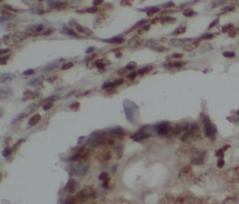 HDAC2 Rabbit Polyclonal Antibody