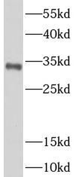 NAT1 Rabbit Polyclonal Antibody
