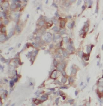 NAT1 Rabbit Polyclonal Antibody