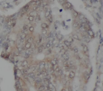 TAB2 Antibody