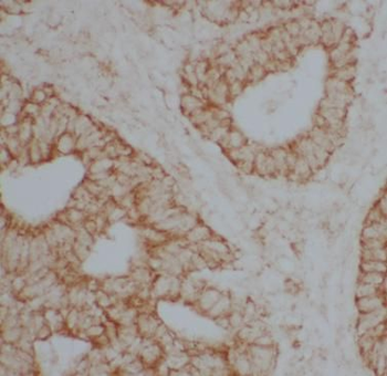 DBH Antibody