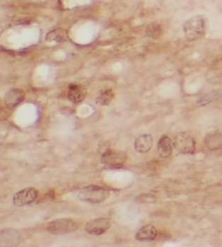 copeptin Antibody