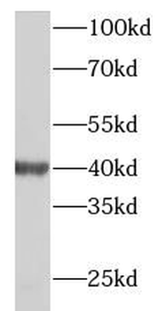 RP2 Rabbit Polyclonal Antibody