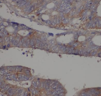 RP2 Rabbit Polyclonal Antibody
