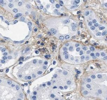 PECAM1 Rabbit Polyclonal Antibody