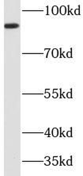 CTNNB1 Rabbit Polyclonal Antibody