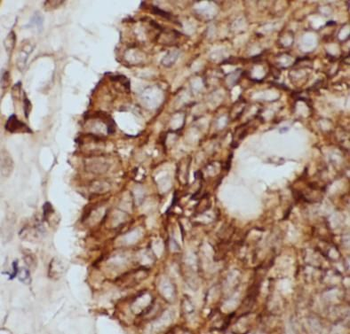 CTNNB1 Rabbit Polyclonal Antibody