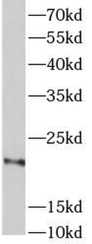 GAL Rabbit Polyclonal Antibody
