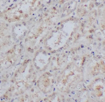 GAL Rabbit Polyclonal Antibody