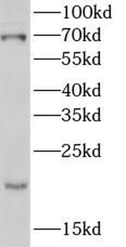 POLL Antibody
