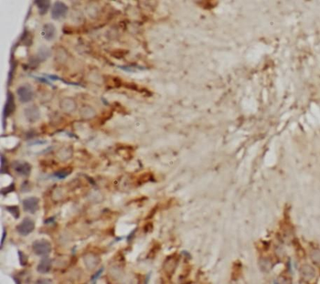 POLL Antibody