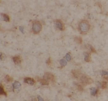 GAB1 Antibody