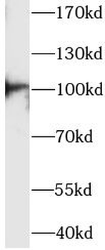 ACTN3 Antibody