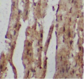 ACTN3 Antibody