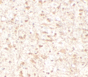 BDNF Rabbit Polyclonal Antibody