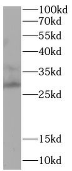 APOBEC3A Antibody
