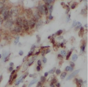 LMO1 Antibody