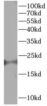 LMO4 Rabbit Polyclonal Antibody