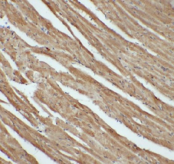 LMO4 Rabbit Polyclonal Antibody